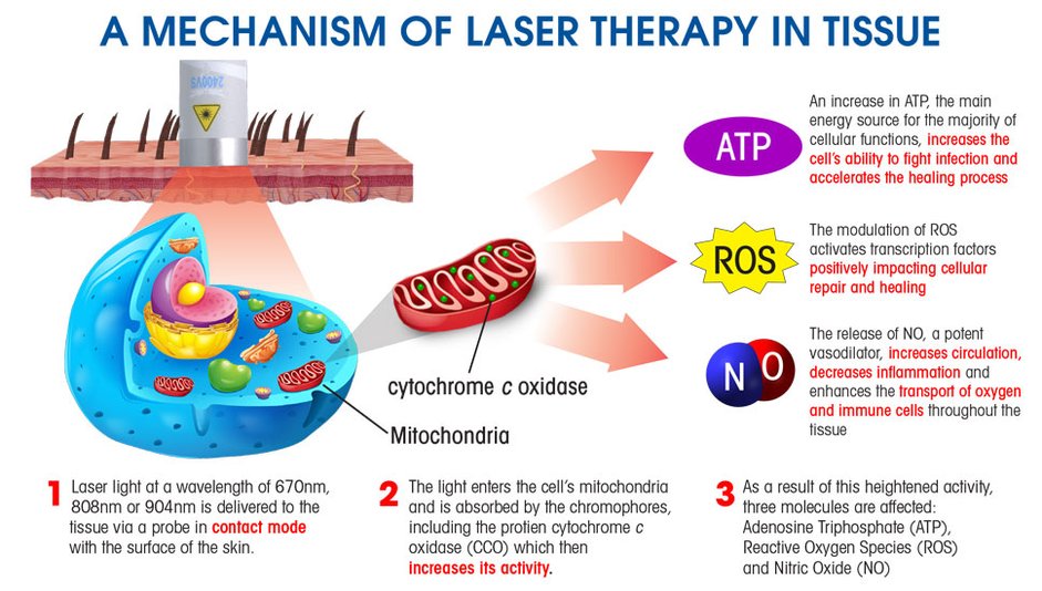laser_diagram.jpg